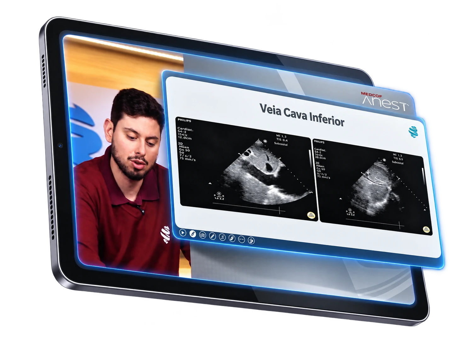 Aula de aprofundamento sobre POCUS de veia cava inferior na plataforma MedCof Anest